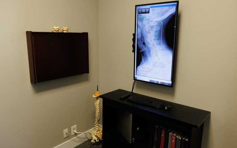 Chiropractor reviewing digital cervical spine X-ray with patient at Omaha Headache Clinic